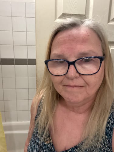 Mirta con su frasco de Restora